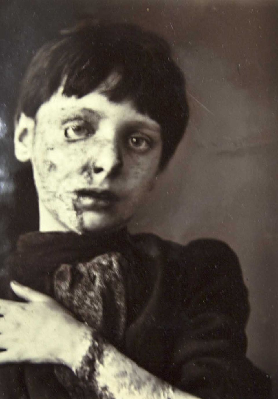 nipper morgan before treatment sm.jpg